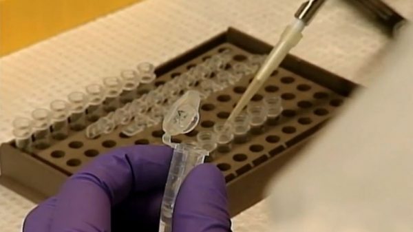 Lutte contre le cancer : Une technologie novatrice arrive à Annaba