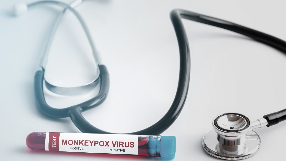 Variole du singe : l’Algérie annonce les premières mesures